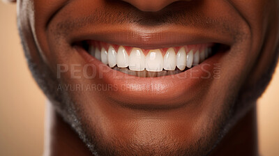 Buy stock photo Closeup of smile with white teeth. Dental care, teeth whitening procedure at dentist.