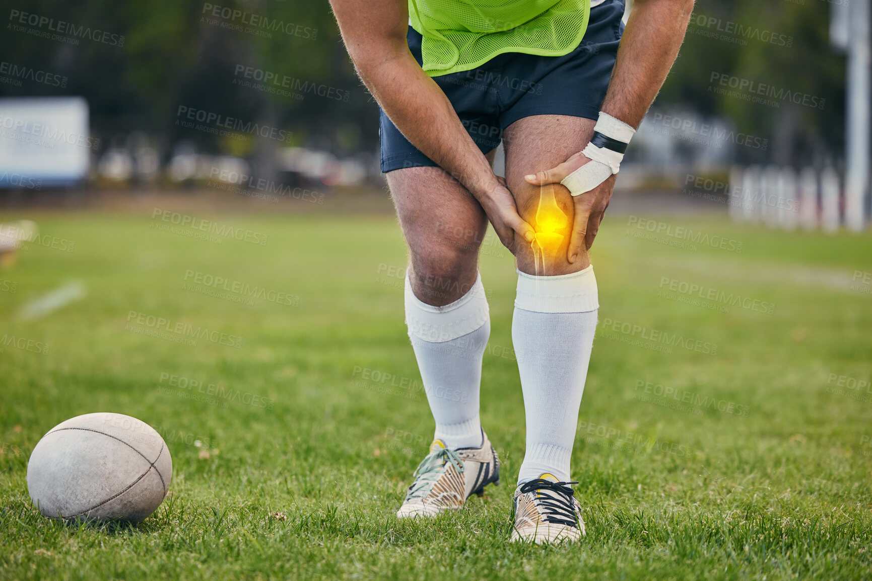 Buy stock photo Rugby, pain and man with knee injury on sports field for practice match, training and game outdoors. Medical emergency, accident and athlete with x ray of joint inflammation, sprain and tendinitis