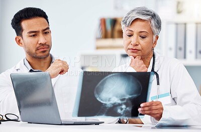 Buy stock photo Doctor, healthcare and skull xray analysis, collaboration and laptop with neuro and assessment of scan. Head injury, radiology and people on surgeon team, review picture with anatomy in hospital