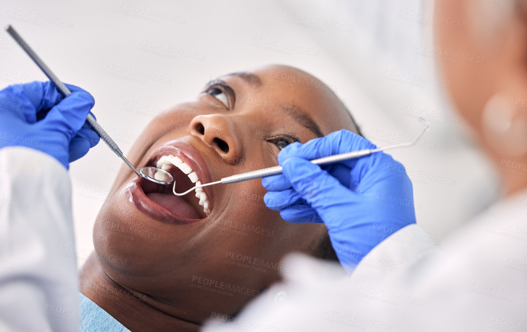 Buy stock photo Dentist, patient and women at clinic, tools in consultation and check mouth for dental health and medical treatment. Oral hygiene, healthcare and surgery, orthodontics and tooth decay with excavator