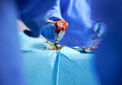 Buy stock photo Hands, surgery and cancer with doctors in a hospital to remove a tumor closeup during a medical procedure. Healthcare, medicine and operation with a surgeon team in a clinic for emergency transplant