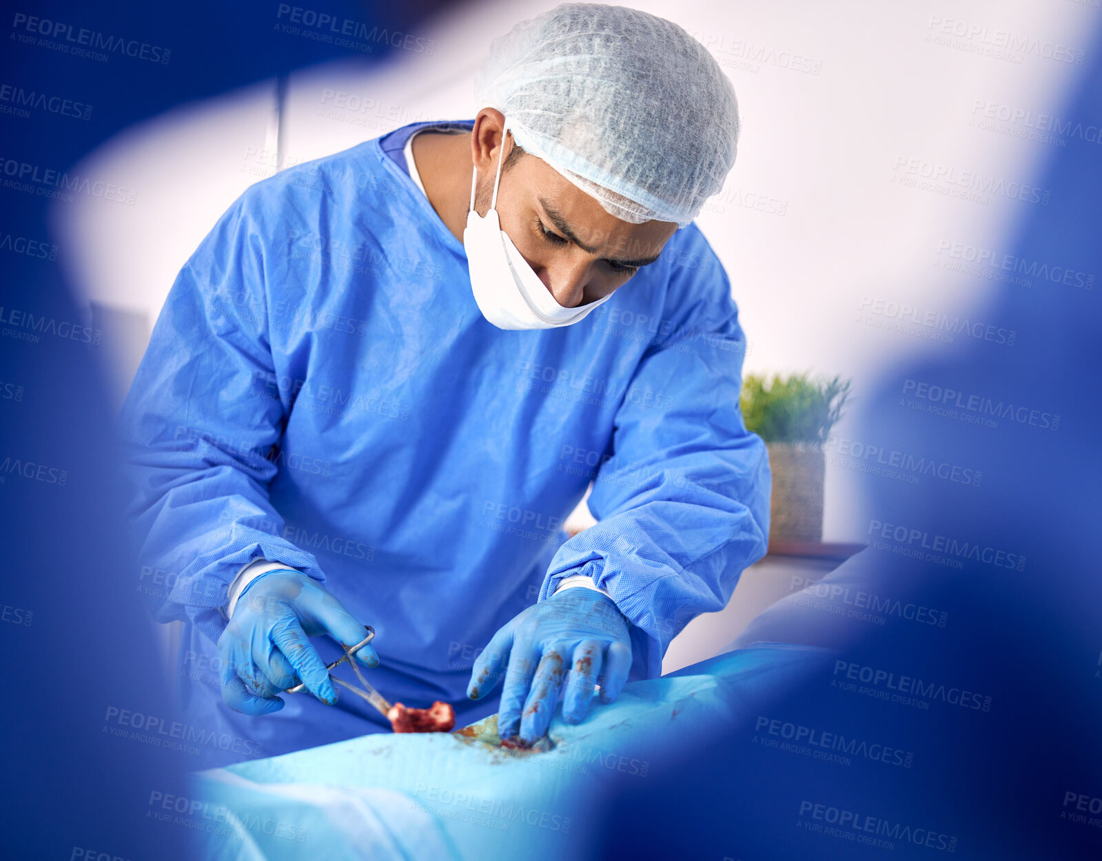 Buy stock photo ER, surgery and doctors team doing emergency operation for organ transplant, treatment or healing anatomy in hospital. Rescue, medical and professional surgeon or healthcare teamwork collaboration