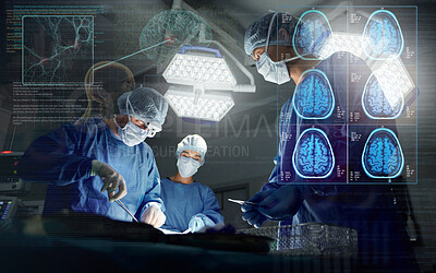 Buy stock photo Surgery, team and overlay neurology working research operation or hospital theater, confident or patient trust. Male person, hands and professional tools for brain anatomy, skull or medical doctors
