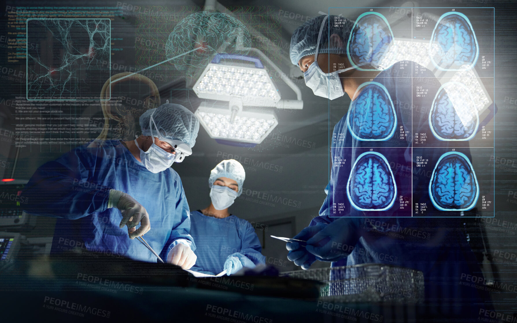 Buy stock photo Surgery, team and overlay neurology working research operation or hospital theater, confident or patient trust. Male person, hands and professional tools for brain anatomy, skull or medical doctors