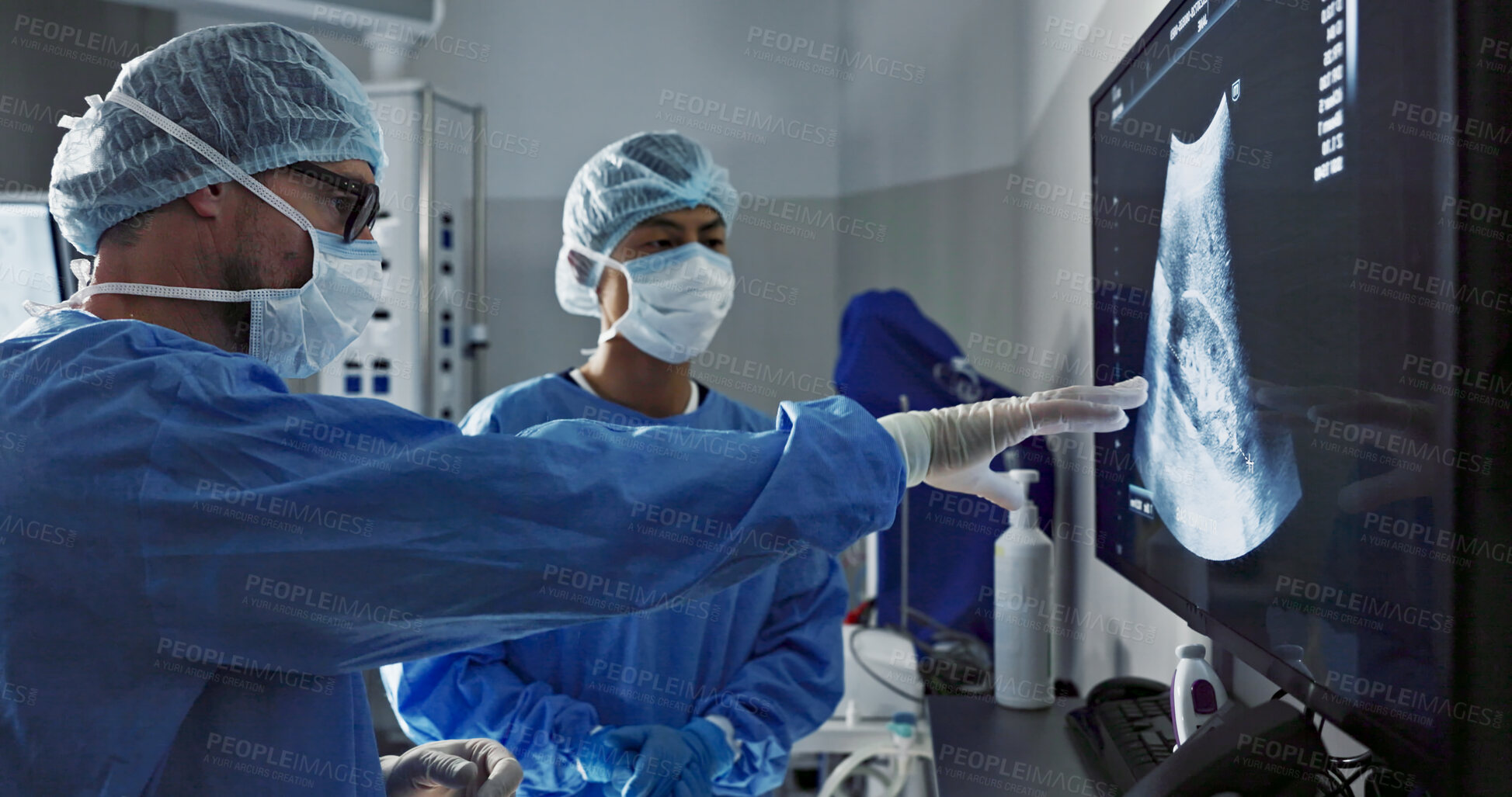 Buy stock photo Surgery, x ray and a team of doctors in the hospital for an operation or procedure to remove a tumor. Healthcare, medical teamwork and a surgeon looking at a screen with a medicine professional