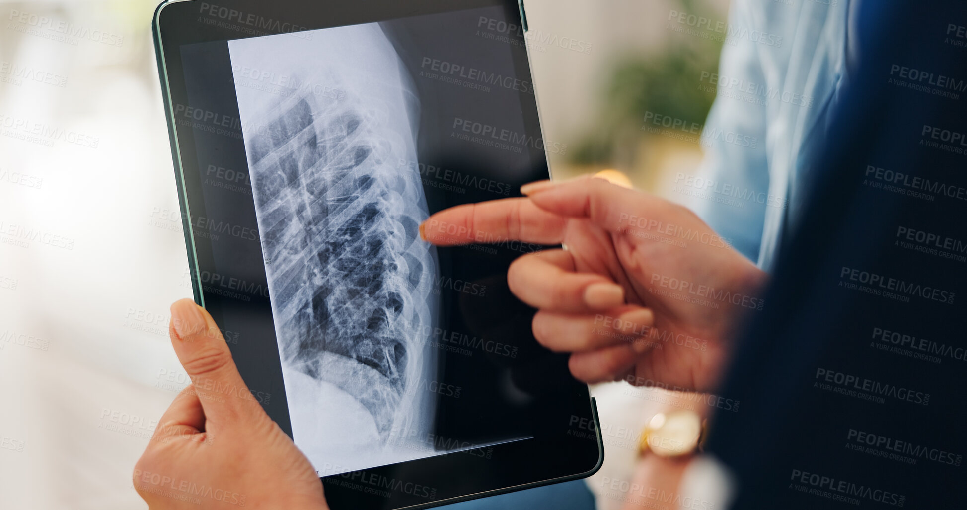 Buy stock photo Healthcare, x ray and tablet for hand in closeup by pointing of injury on screen in consulting. Medical professional, doctor or person for technology of results, diagnosis or bone fracture of patient
