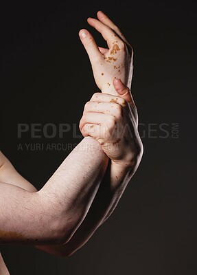 Buy stock photo Hand, vitiligo and man in studio for skincare, grooming and hygiene against black background with mockup. Hands, skin and guy model with melanin, pigmentation and product for body positivity mock up