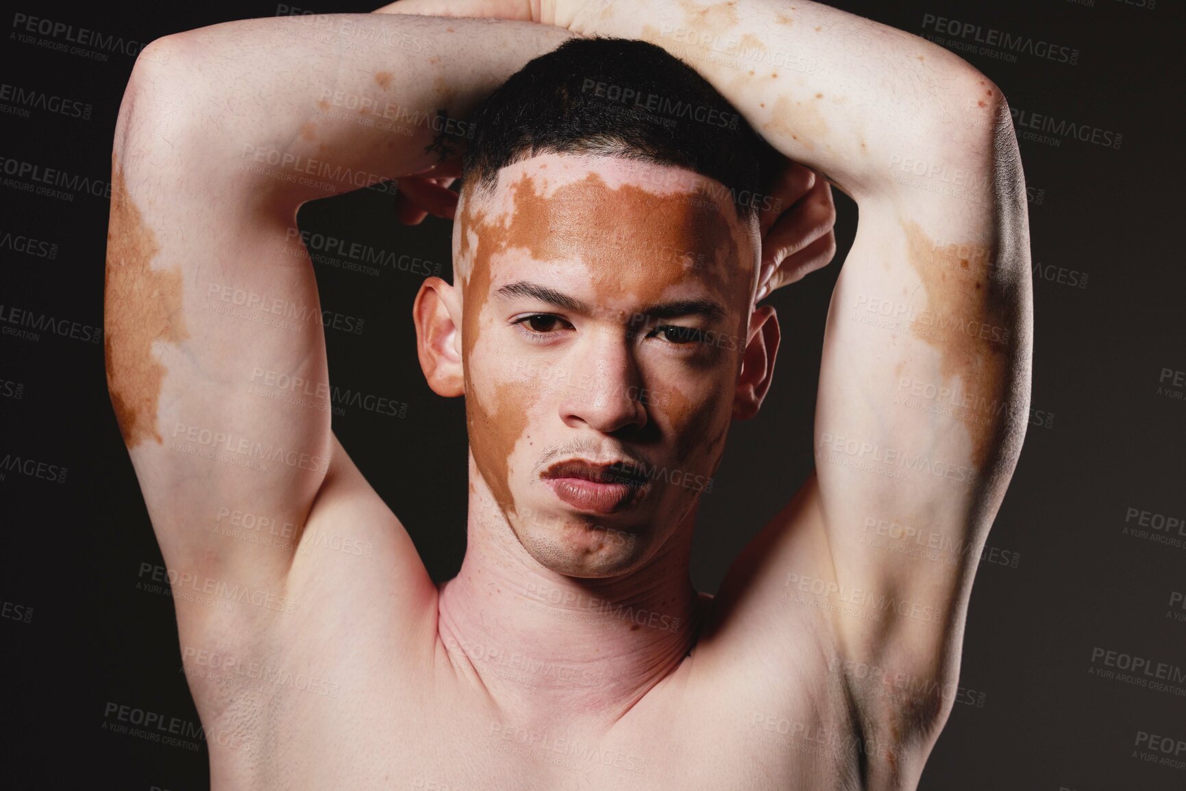 Buy stock photo Skincare, beauty and portrait of man with vitiligo on black background for wellness, dermatology and body care. Fashion, cosmetics and face of male with natural, healthy and glowing skin in studio