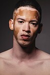 Vitiligo, skincare and portrait of black man with beauty, wellness face and luxury cosmetic against dark black studio background. Healthy body, facial dermatology and African model with care of skin