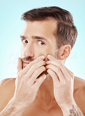 Buy stock photo Man, portrait and face or skin with acne or pimple problem with dermatology for self care studio. Model with hands to check or press spot for skincare or facial health and wellness on blue background