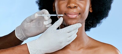 Buy stock photo Black woman, face injection and beauty with lip filler, cosmetic procedure and dermatology on blue background. Liquid collagen, mouth and skincare with hands, female model and smile in portrait