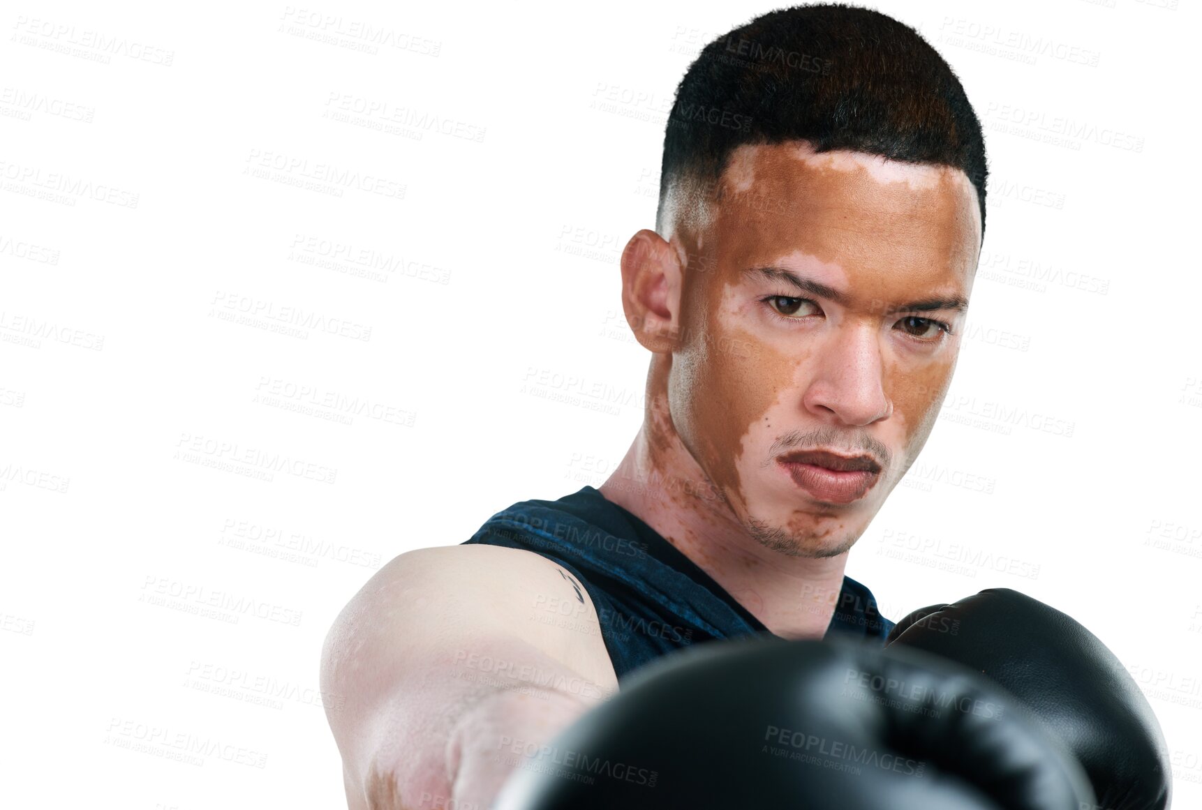 Buy stock photo Man with vitiligo, portrait and boxing for fight, self defense or training isolated on a transparent PNG background. Face of male person, boxer or fighter with skin pigmentation and gloves in sport