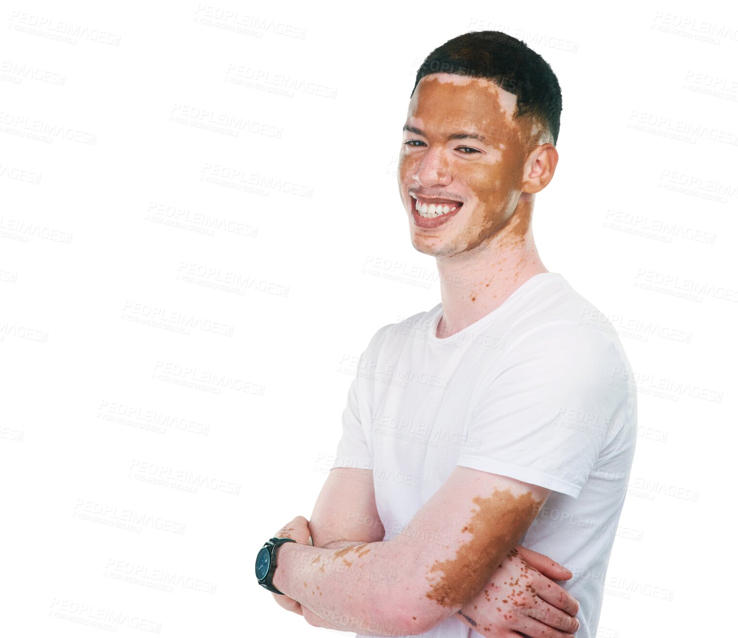 Buy stock photo Isolated man, happy and arms crossed with fashion, thinking and vision with style by transparent png background. Student guy, face and person with vitiligo, trendy tshirt and unique with memory