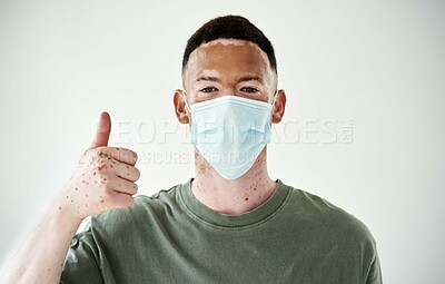 Buy stock photo Studio portrait of a young man with vitiligo wearing a mask and showing thumbs up against a white background