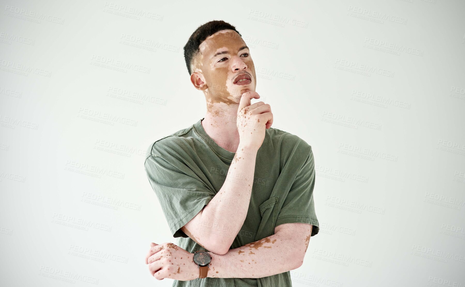 Buy stock photo Memory, man against a studio backdrop and thinking for problem solving. Solution or decision, remember or doubt and isolated young male person with vitiligo against white background for inspiration