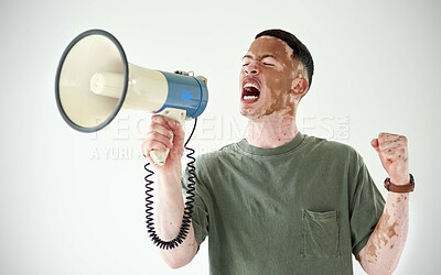 Buy stock photo Studio shot of a young man with vitiligo using a megaphone against a white background