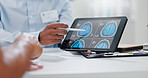 Doctor, hands and tablet with brain scan for patient, consultation or examination results at hospital. Closeup of person, medical employee or nurse pointing to technology for MRI at neurology clinic