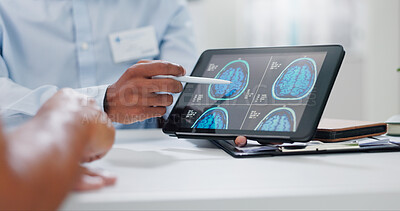 Buy stock photo Doctor, hands and tablet with brain scan for patient, consultation or examination results at hospital. Closeup of person, medical employee or nurse pointing to technology for MRI at neurology clinic