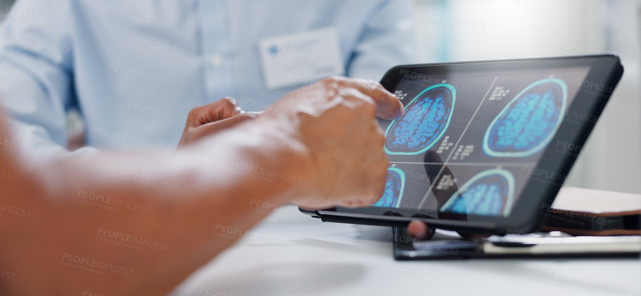 Buy stock photo Doctor, hands and tablet with brain scan for patient, consultation or examination results at hospital. Closeup of person, medical employee or nurse pointing to technology for MRI at neurology clinic
