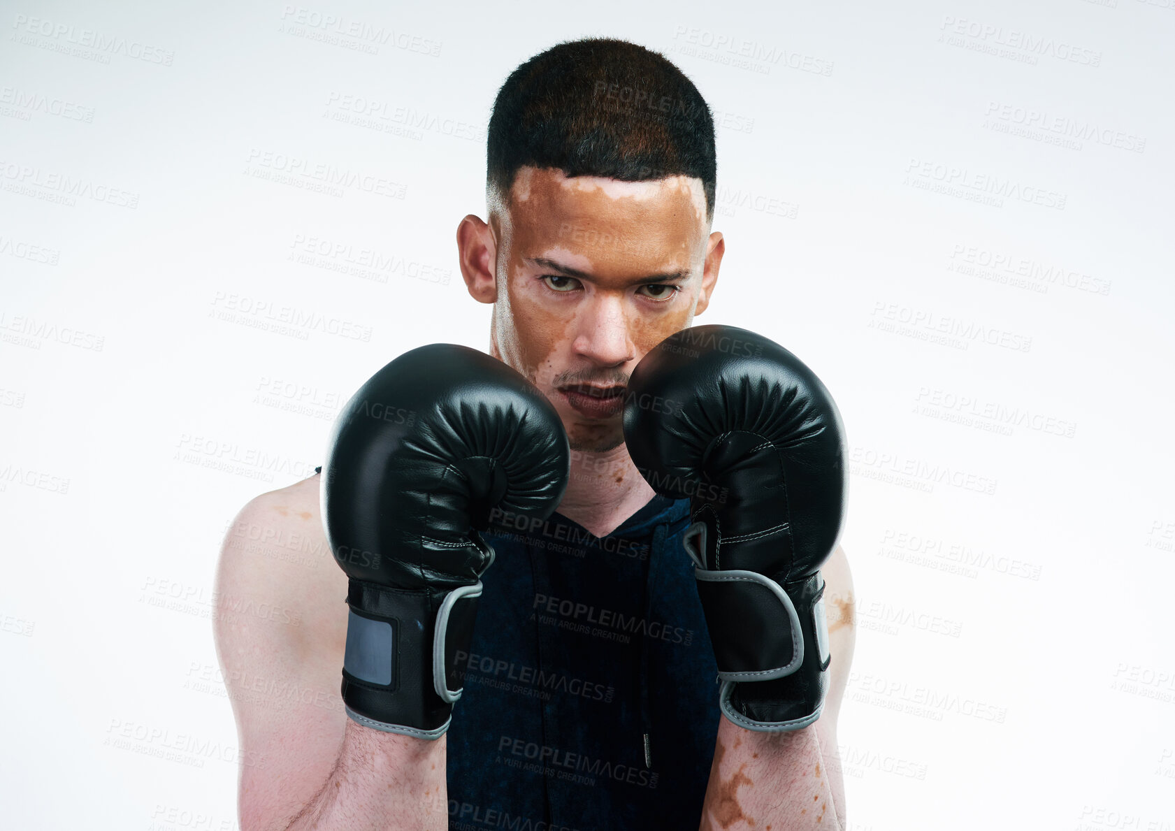 Buy stock photo Serious man, portrait and boxer with gloves for fight, tournament or boxing match on a white studio background. Male person, vitiligo or fighter ready for self defense, MMA challenge or competition