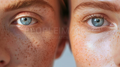 Buy stock photo Closeup, eyes and vision with portrait, people and compare for optical care and eyesight or optometry together. Woman, twins or support with face, family and healthcare with genetics and skin freckle