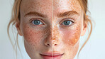 Woman, eyes and portrait with freckles in skincare pigmentation or spot correction for melanin. Closeup of face with spotted skin for compare, before and after in genetics, asymmetry or aging results