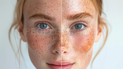 Woman, eyes and portrait with freckles in skincare pigmentation or spot correction for melanin. Closeup of face with spotted skin for compare, before and after in genetics, asymmetry or aging results