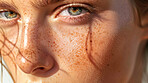 Woman, eyes and portrait with melasma on face for skincare, medical condition and healthcare. Female person, cosmetic and natural shine with pigmentation for UV radiation, genetics and sunshine