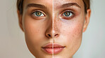 Compare, woman and dermatology for clear skin, cosmetics and beauty on grey studio background. Face, person and girl with change, versus and model with condition, solution and promotion for treatment