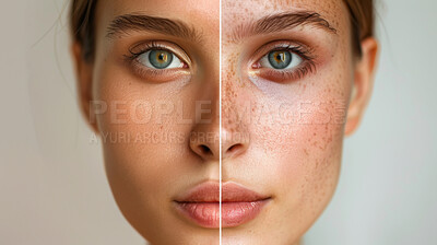 Compare, woman and dermatology for clear skin, cosmetics and beauty on grey studio background. Face, person and girl with change, versus and model with condition, solution and promotion for treatment
