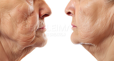 Senior people, face and wrinkles to compare results for anti aging, skincare or health by white background. Profile, closeup or versus for lines, facial change or transformation after chemical filler