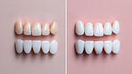 Compare, teeth whitening and colouring with oral health and dental hygiene on pink studio background. Calcium, results and healthy with fresh breath, change or care with checkup, treatment and plaque