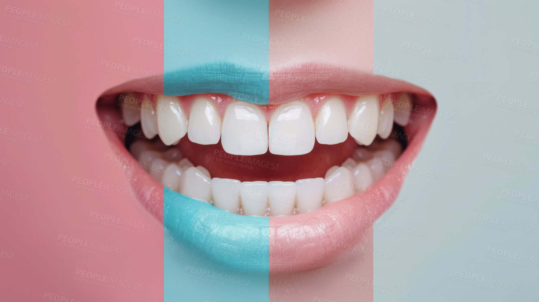 Buy stock photo Teeth, dental and pattern with smile for hygiene, veneers or surgery of mouth, lips or gums on colorful background. Closeup of young person in tooth whitening, dentist or clean oral care with stripes