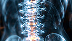 Medical, anatomy and 3d xray of spine with inflammation for osteoporosis, disease or scoliosis. Healthcare, neuroscience and radiology with scan of skeleton for infection, evaluation and examination