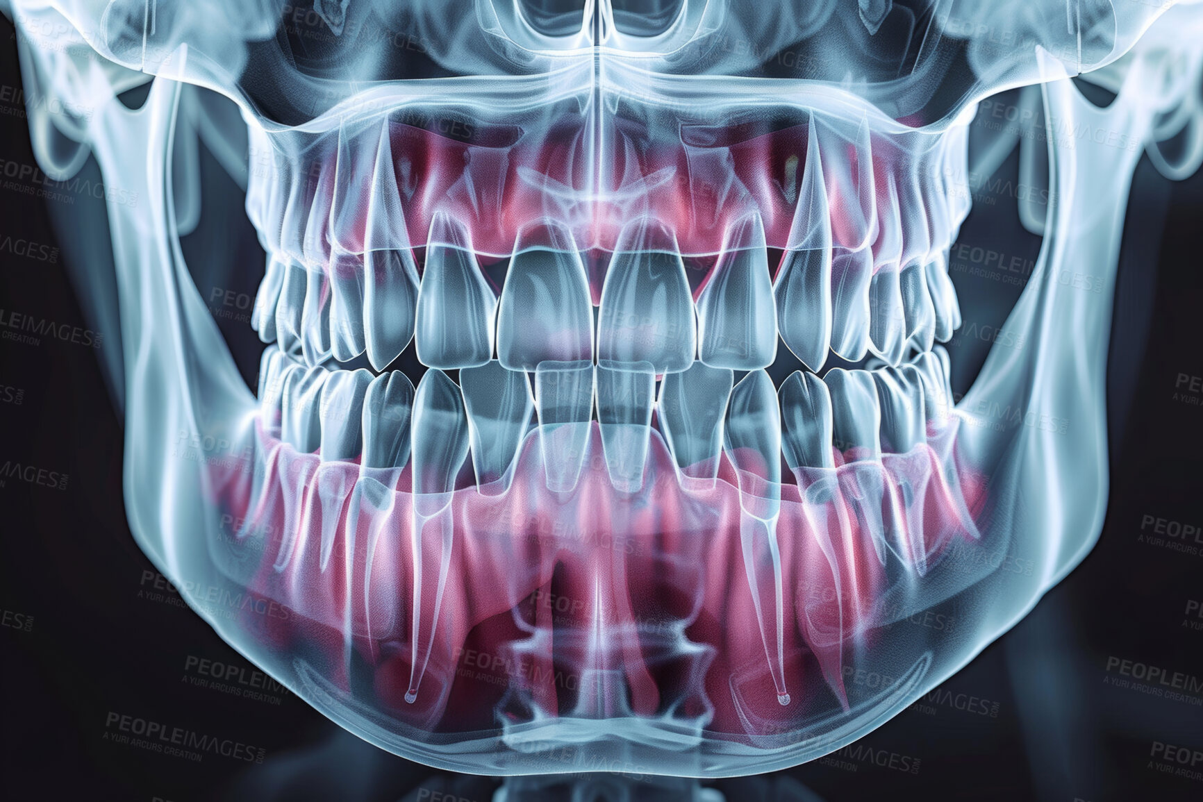 Buy stock photo Jaw, teeth and dental x ray with future dentistry, AI and technology for healthcare with oral anatomy. Bone, medical results and radiology with skeleton, virtual reality surgery and orthodontics