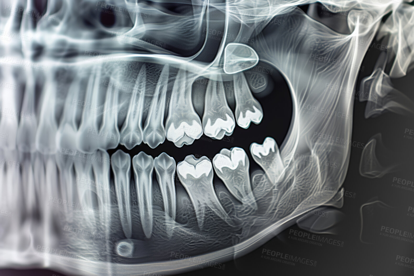 Buy stock photo Medical, xray and illustration of teeth in mouth for wisdom tooth, growth and dental examination. Anatomy, radiology and dentistry in healthcare with scan for root canal, assessment and evaluation