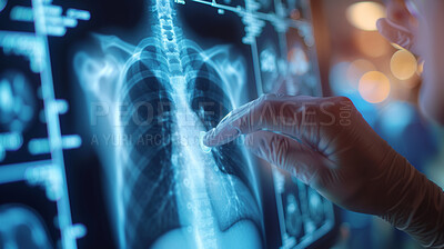 Doctor, hands and medical xray of lungs for asthma, cancer and tuberculosis research with anatomy hologram. Person, finger and future medicare innovation with dashboard for analytics of patient