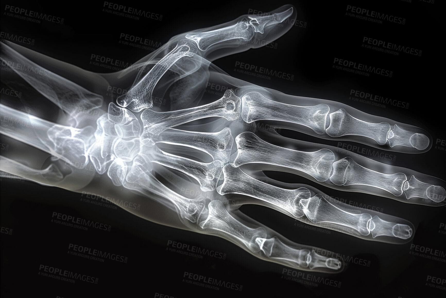 Buy stock photo Xray, anatomy and hand skeleton on film, body injury and scan and vertebrae or radiology examination. Joints, mri radiation and bone image or internal structure, assessment and health in hospital