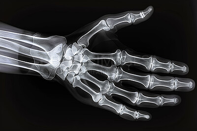 Film, x ray or hand or isolated for medical graphic, surgery or injury with healthcare. Radiography, skeleton and anatomy or profile and alone, inspection of human with scan for fracture of palm
