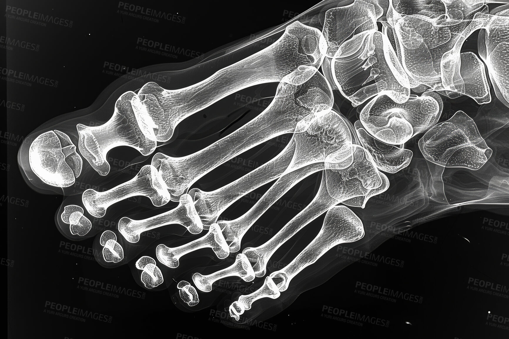 Buy stock photo Xray, anatomy and foot skeleton on film, human body and assessment for radiology examination. Joints, medicine radiation and bone image or internal structure, polydactyly abnormality or defect