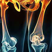 Skeleton, legs and x ray of pelvis on black background for injury ...