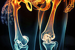 Skeleton, legs and x ray of pelvis on black background for injury assessment, bone diagnostic or osteoporosis. Radiography, medical imaging and glow for inflammation, arthritis and scan of anatomy.