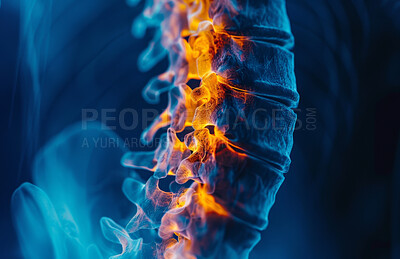 Spine, inflammation and back pain as nerve healthcare or vertebra pressure, tension or overlay. X ray, life insurance and herniated disc with skeleton bone or diagnosis surgery, fracture or scoliosis