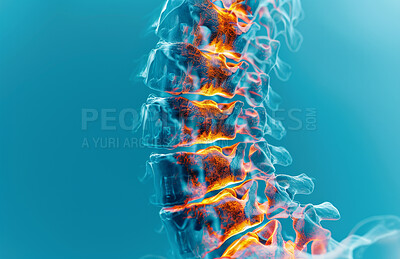 Spine, injury and inflammation pain as x ray on blue background for skeleton bone, scoliosis or emergency. Vertebra, accident and healthcare with strain problem with joint scan, tender or anatomy