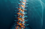 Spine, inflammation and back pain or injury x ray for vertebra pressure, tension or overlay. Joint, anatomy and herniated disc with skeleton bone or emergency surgery as strain, fracture or scoliosis