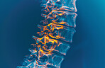 Inflammation, spine and 3D in xray for medicare, healthcare or radiology at hospital or clinic. Injury, bone and nerve for medical, research and diagnosis of patient as results in scan for scoliosis