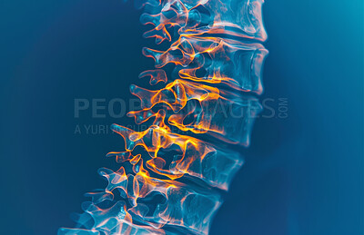 Inflammation, spine and 3D in xray for medicare, healthcare or radiology at hospital or clinic. Injury, bone and nerve for medical, research and diagnosis of patient as results in scan for scoliosis
