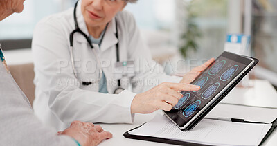 Woman, doctor and hands on tablet with brain scan or patient in medical examination, results or anatomy at clinic. Closeup of healthcare professional consulting customer on technology for xray or MRI