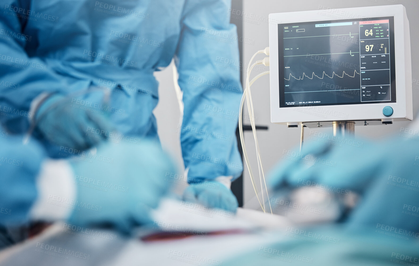 Buy stock photo Hands, monitor and operation with a team of doctors at work during surgery with equipment or a tool in a hospital. Doctor, nurse and collaboration with a medicine professional group saving a life