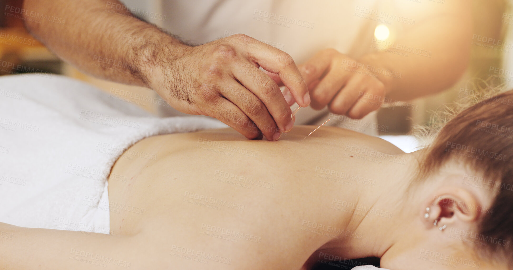 Buy stock photo Acupuncture, back and hands in spa to relax with customer treatment for healing, stress relief or therapy. Body, dry needling and holistic with masseuse in resort for cosmetics, massage and skincare